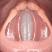 1507912086-2971725602_q