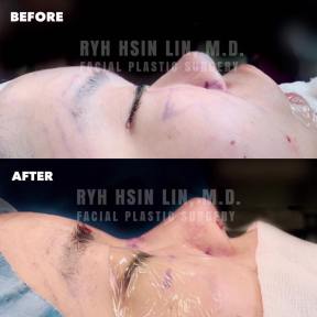 56277936_325064644863952_7839348929144553472_n