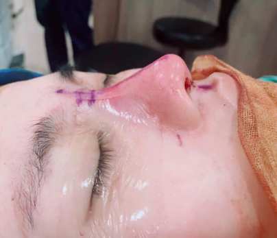 91562141_537195820317499_6937412011802230784_n