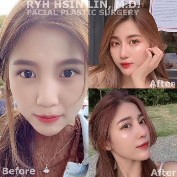 106171525_592818814755199_501283868677889763_n