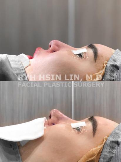 103488866_585357525501328_3427610038078141928_n