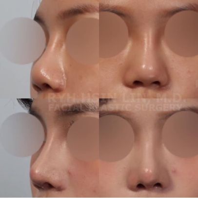 93305488_542401803130234_4963028495157428224_n