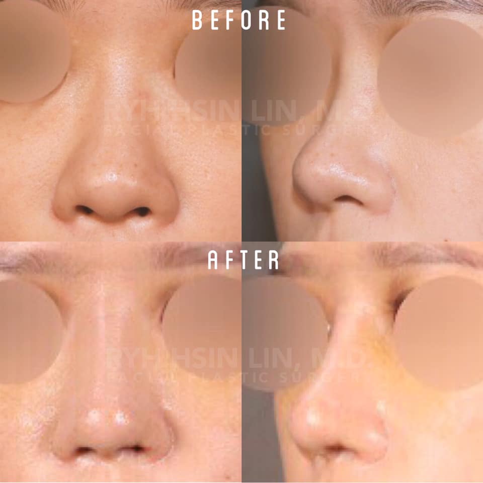 72303930_411000712937011_1293853481966239744_n