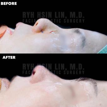 60087801_343152626388487_5524895777517731840_n