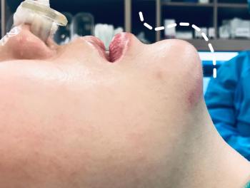 57504260_333923193978097_7150866539179147264_n